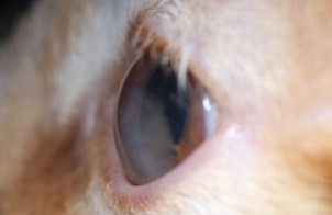 Ocular Sign 2